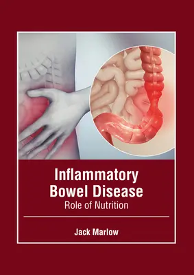 Choroba zapalna jelit: Rola odżywiania - Inflammatory Bowel Disease: Role of Nutrition