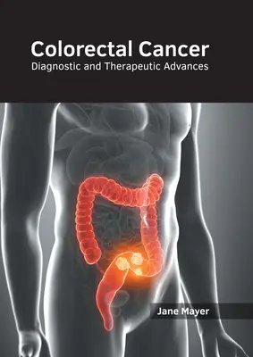 Rak jelita grubego: Postępy w diagnostyce i terapii - Colorectal Cancer: Diagnostic and Therapeutic Advances