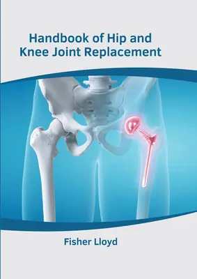 Podręcznik wymiany stawu biodrowego i kolanowego - Handbook of Hip and Knee Joint Replacement