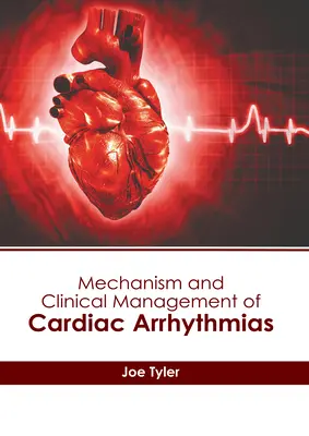 Mechanizm i postępowanie kliniczne w zaburzeniach rytmu serca - Mechanism and Clinical Management of Cardiac Arrhythmias