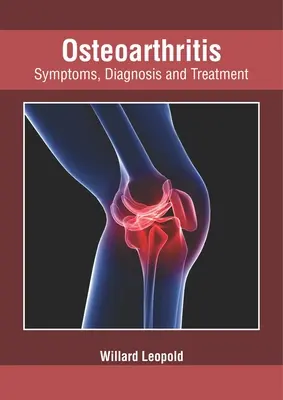 Choroba zwyrodnieniowa stawów: Objawy, diagnoza i leczenie - Osteoarthritis: Symptoms, Diagnosis and Treatment