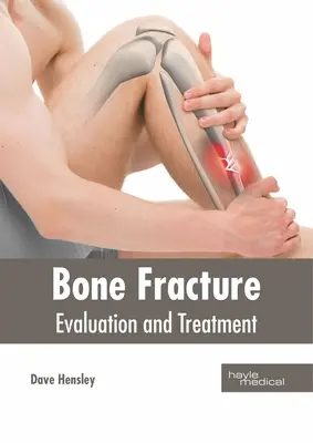 Złamanie kości: Ocena i leczenie - Bone Fracture: Evaluation and Treatment