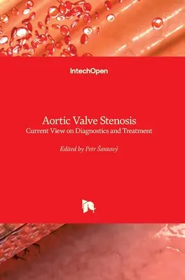 Zwężenie zastawki aortalnej: Aktualne poglądy na diagnostykę i leczenie - Aortic Valve Stenosis: Current View on Diagnostics and Treatment