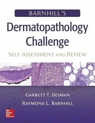 Wyzwanie dermatopatologiczne Barnhill: samoocena i przegląd - Barnhill's Dermatopathology Challenge: Self-Assessment & Review