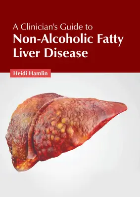 Przewodnik klinicysty po niealkoholowej stłuszczeniowej chorobie wątroby - A Clinician's Guide to Non-Alcoholic Fatty Liver Disease
