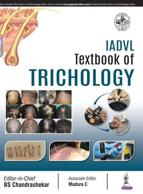 Podręcznik trychologii IADVL - IADVL Textbook of Trichology