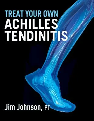 Leczenie zapalenia ścięgna Achillesa we własnym zakresie - Treat Your Own Achilles Tendinitis