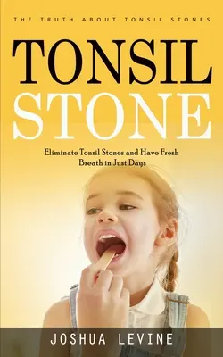 Kamienie na migdałkach: Prawda o kamieniach migdałkowych (Wyeliminuj kamienie migdałkowe i miej świeży oddech w kilka dni!) - Tonsil Stones: The Truth about Tonsil Stones (Eliminate Tonsil Stones and Have Fresh Breath in Just Days!)