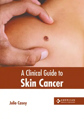 Przewodnik kliniczny po raku skóry - A Clinical Guide to Skin Cancer