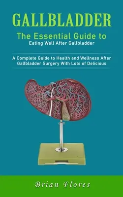 Woreczek żółciowy: The Essential Guide to Eating Well After Gallbladder: (Kompletny przewodnik po zdrowiu i dobrym samopoczuciu po operacji pęcherzyka żółciowego) - Gallbladder: The Essential Guide to Eating Well After Gallbladder (A Complete Guide to Health and Wellness After Gallbladder Surger