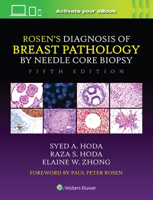 Rosen's Diagnosis of Breast Pathology by Needle Core Biopsy (Diagnostyka patologii piersi metodą biopsji gruboigłowej) - Rosen's Diagnosis of Breast Pathology by Needle Core Biopsy
