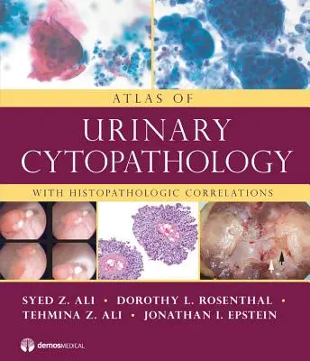 Atlas cytopatologii układu moczowego: Z korelacjami histopatologicznymi - Atlas of Urinary Cytopathology: With Histopathologic Correlations