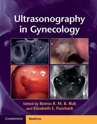 Ultrasonografia w ginekologii - Ultrasonography in Gynecology