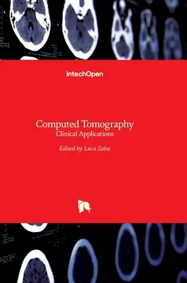 Tomografia komputerowa: Zastosowania kliniczne - Computed Tomography: Clinical Applications