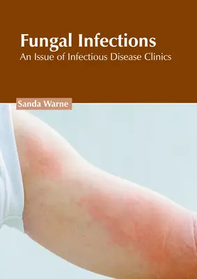 Zakażenia grzybicze: Wydanie klinik chorób zakaźnych - Fungal Infections: An Issue of Infectious Disease Clinics