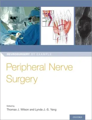 Chirurgia nerwów obwodowych - Peripheral Nerve Surgery