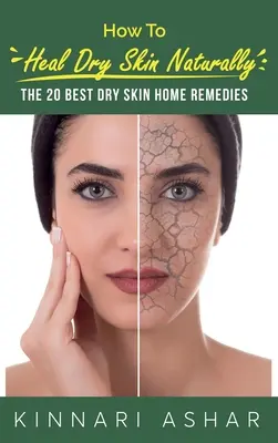 Jak naturalnie leczyć suchą skórę: 20 najlepszych domowych sposobów na suchą skórę - How to Heal Dry Skin Naturally: The 20 Best Dry Skin Home Remedies