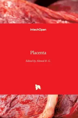 Łożysko - Placenta