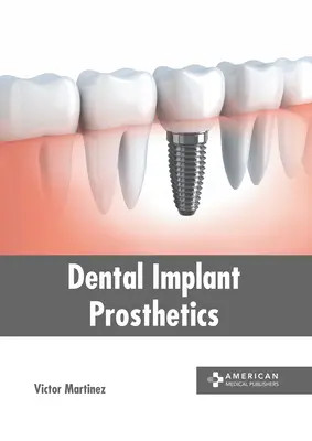 Protetyka implantów dentystycznych - Dental Implant Prosthetics