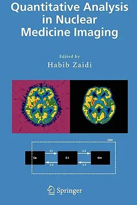 Analiza ilościowa w obrazowaniu medycyny nuklearnej - Quantitative Analysis in Nuclear Medicine Imaging