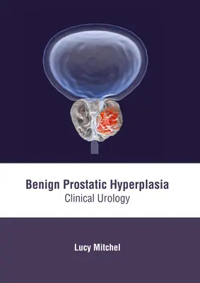 Łagodny przerost gruczołu krokowego: urologia kliniczna - Benign Prostatic Hyperplasia: Clinical Urology