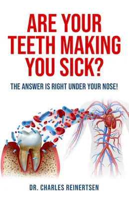 Czy przez zęby chorujesz: odpowiedź jest tuż pod nosem - Are Your Teeth Making You Sick?: The Answer Is Right Under Your Nose
