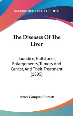 Choroby wątroby: Żółtaczka, kamienie żółciowe, powiększenia, guzy i rak oraz ich leczenie (1895) - The Diseases Of The Liver: Jaundice, Gallstones, Enlargements, Tumors And Cancer, And Their Treatment (1895)