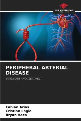 Choroba tętnic obwodowych - Peripheral Arterial Disease