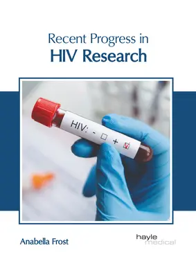 Najnowsze postępy w badaniach nad HIV - Recent Progress in HIV Research