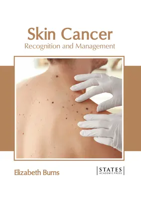 Rak skóry: Rozpoznawanie i leczenie - Skin Cancer: Recognition and Management