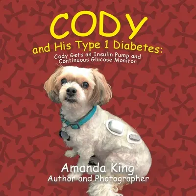 Cody i jego cukrzyca typu 1: Cody otrzymuje pompę insulinową i ciągły monitor glukozy - Cody and His Type 1 Diabetes: Cody Gets an Insulin Pump and Continuous Glucose Monitor