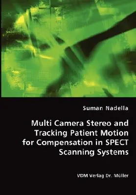 Stereo z wieloma kamerami i śledzenie ruchu pacjenta w celu kompensacji w systemach skanowania SPECT - Multi Camera Stereo and Tracking Patient Motion for Compensation in SPECT Scanning Systems