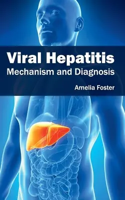 Wirusowe zapalenie wątroby: Mechanizm i diagnoza - Viral Hepatitis: Mechanism and Diagnosis