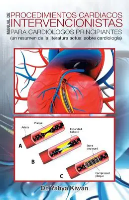 Manual de procedimientos cardiacos intervencionistas para cardilogos principiantes: