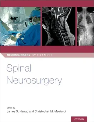 Neurochirurgia kręgosłupa - Spinal Neurosurgery