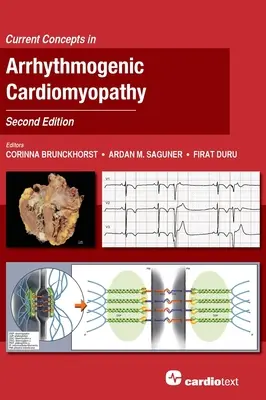 Aktualne koncepcje kardiomiopatii arytmogennej, wydanie drugie - Current Concepts in Arrhythmogenic Cardiomyopathy, Second Edition