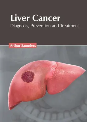 Rak wątroby: Diagnoza, zapobieganie i leczenie - Liver Cancer: Diagnosis, Prevention and Treatment