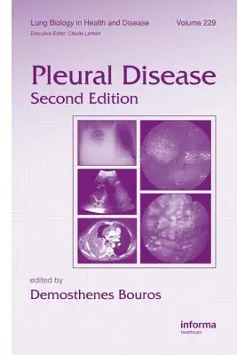 Choroba opłucnej - Pleural Disease