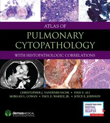 Atlas cytopatologii płucnej - Atlas of Pulmonary Cytopathology