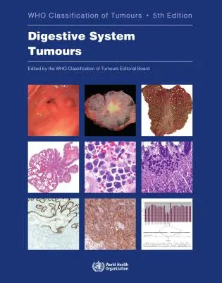 Nowotwory układu pokarmowego: Kto klasyfikuje nowotwory - Digestive System Tumours: Who Classification of Tumours