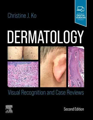 Dermatologia: Rozpoznawanie wizualne i przeglądy przypadków - Dermatology: Visual Recognition and Case Reviews