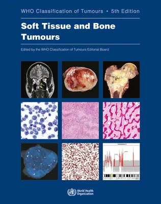 Nowotwory tkanek miękkich i kości: Kto klasyfikuje nowotwory - Soft Tissue and Bone Tumours: Who Classification of Tumours