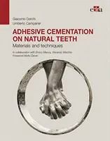 Cementowanie adhezyjne zębów naturalnych - materiały i techniki - Adhesive cementation on natural teeth - Materials and techniques