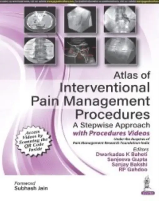 Atlas interwencyjnych procedur leczenia bólu - Atlas of Interventional Pain Management Procedures