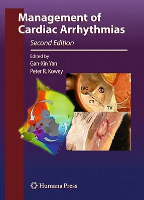 Zarządzanie zaburzeniami rytmu serca - Management of Cardiac Arrhythmias