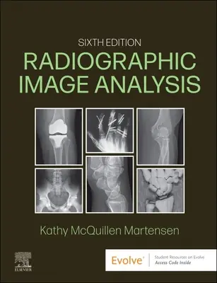 Analiza obrazów radiograficznych - Radiographic Image Analysis
