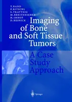 Obrazowanie guzów kości i tkanek miękkich: Podejście oparte na studium przypadku - Imaging of Bone and Soft Tissue Tumors: A Case Study Approach
