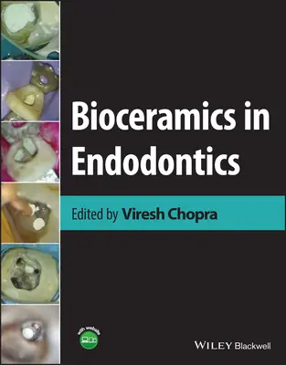 Bioceramika w endodoncji - Bioceramics in Endodontics