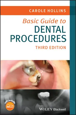 Podstawowy przewodnik po procedurach dentystycznych - Basic Guide to Dental Procedures