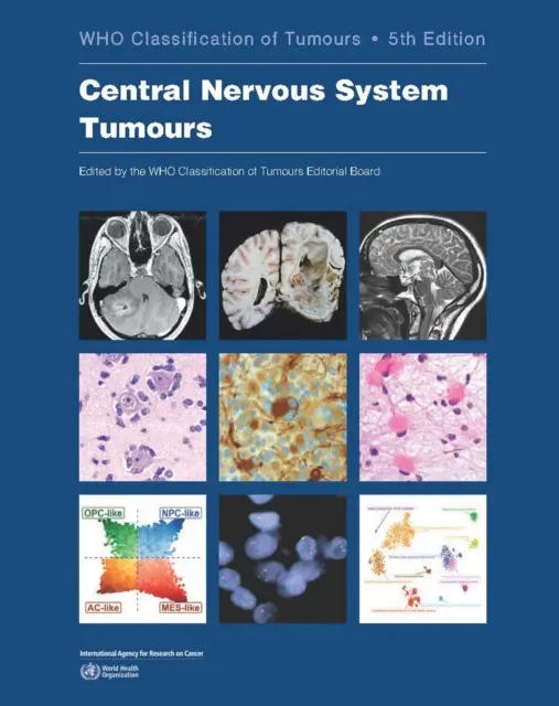 Nowotwory ośrodkowego układu nerwowego: Kto klasyfikuje nowotwory - Central Nervous System Tumours: Who Classification of Tumours